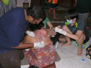 Medical Seva Nanga Sumpa Iban Longhouse Borneo 03